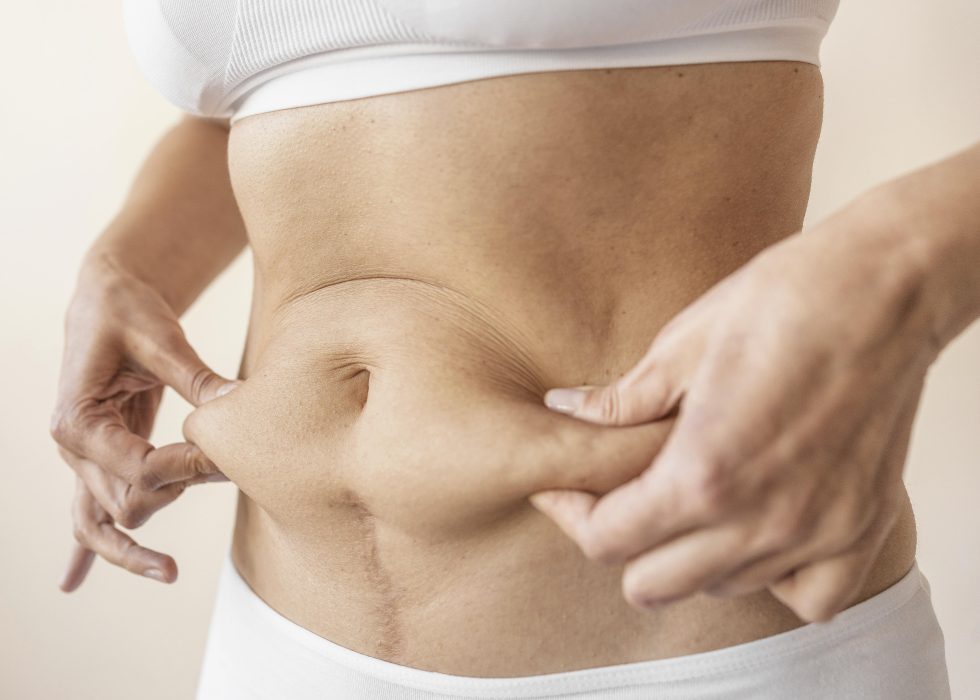 Abdominoplasty / Tummy Tuck in Kenya